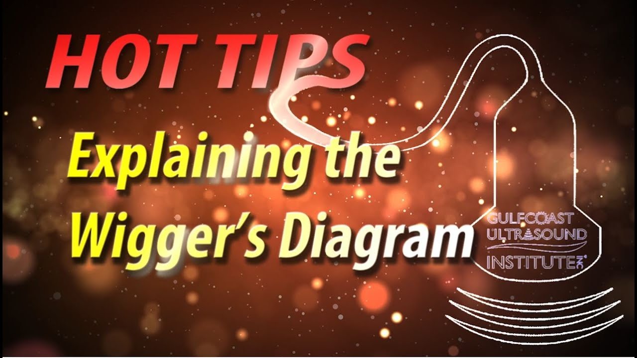 The Wiggers Diagram Explained In Just Over 3 Minutes!